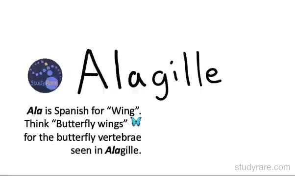 Alagille syndrome mnemonic: "Ala" means wing in Spanish; think butterfly wings for the butterfly vertebrae