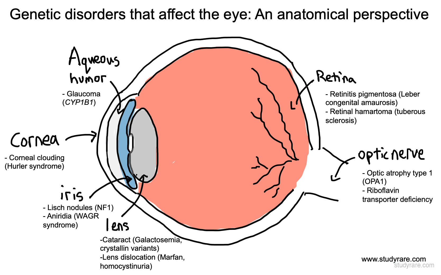 Genetic disorders that affect the eye