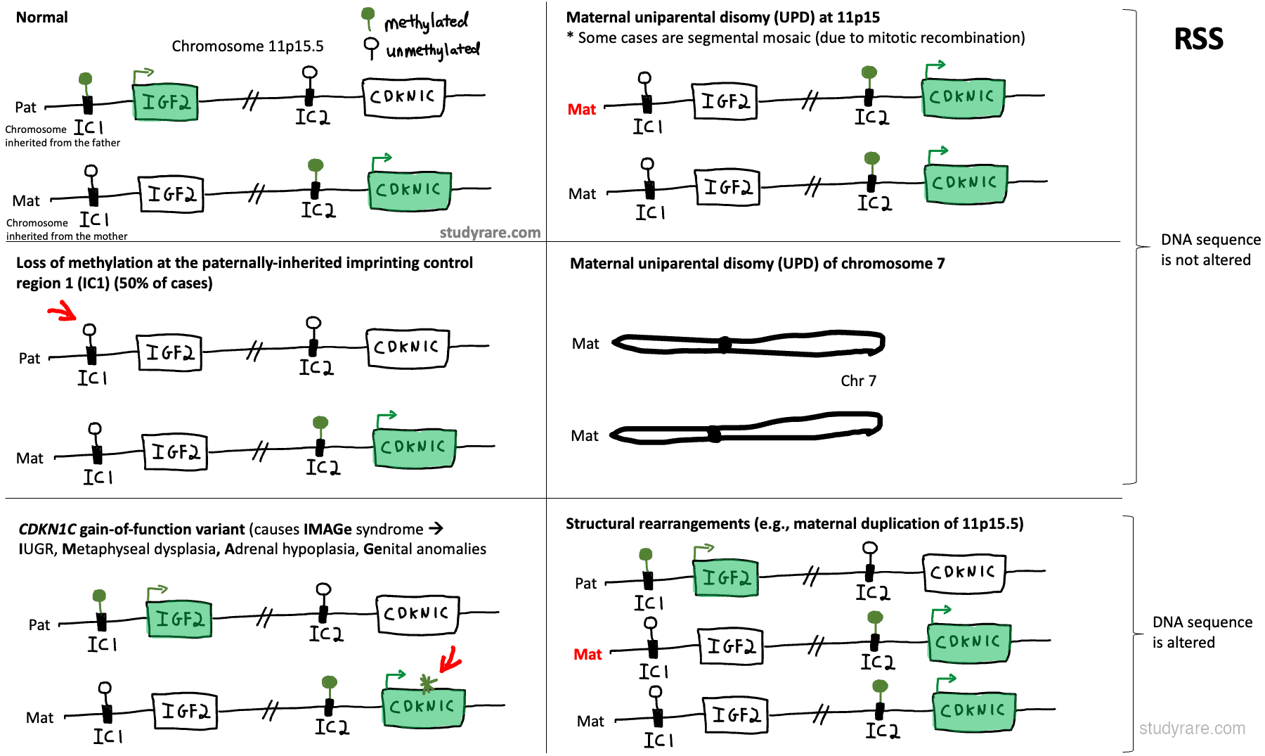 Russell-Silver syndrome molecular mechanisms: IC1 hypomethylation, maternal UPD at 11p15, maternal UPD of chromosome 7, and structural rearrangements