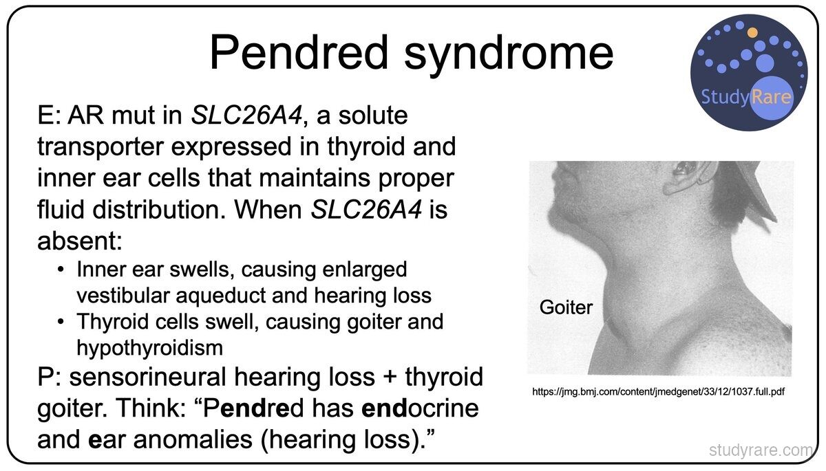 Pendred syndrome overview: AR mutation in SLC26A4 causing enlarged vestibular aqueduct with hearing loss and thyroid goiter with hypothyroidism; "Pendred has endocrine and ear anomalies"