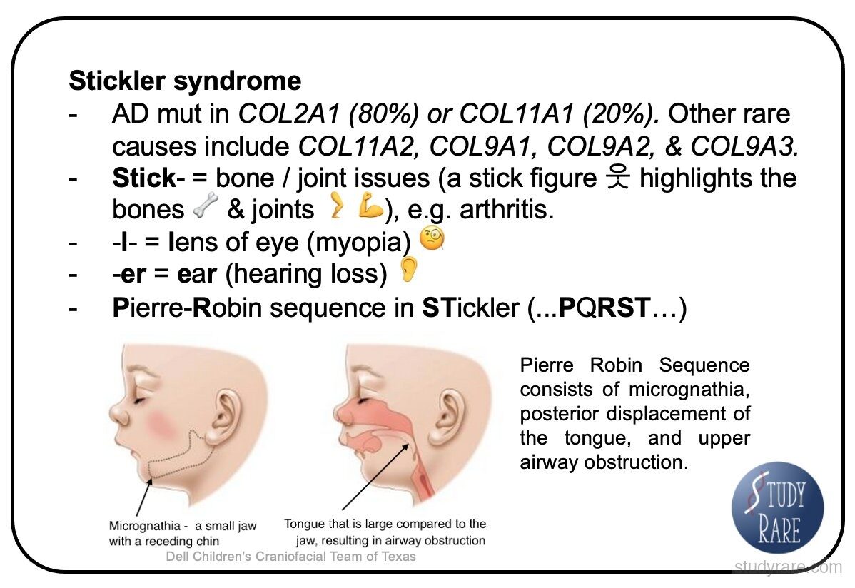 Stickler syndrome comprehensive overview: AD COL2A1 (80%) or COL11A1 (20%), bone/joint issues from "Stick-", lens of eye from "-l-", ear from "-er", Pierre-Robin sequence in STickler (...PQRST...), with clinical images of micrognathia